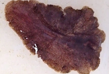 Postenterogonia orbicularis